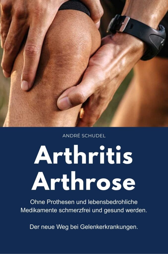 Arthritis